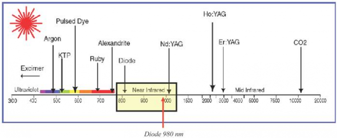 30Mhz permanenti rendono paricolare il laser di rimozione della vena del ragno per la lunghezza d'onda del fronte/corpo/gamba 980nm
