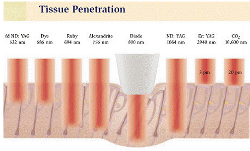 Rendimento elevato di riduzione permanente dei capelli di IPL, dispositivo di rimozione leggero pulsato intenso dei capelli