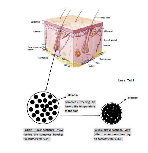 Macchina multifunzionale Fluence regolabile di depilazione del laser a diodi di ringiovanimento