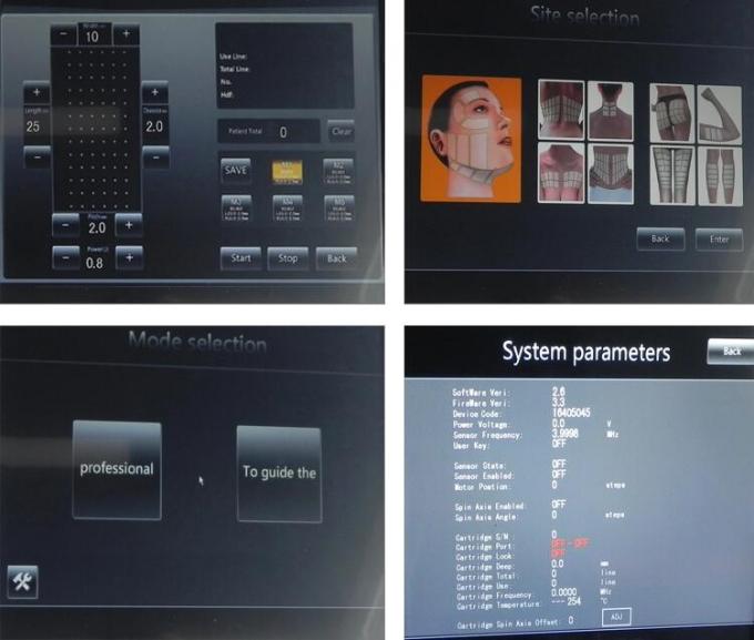 macchine di bellezza di 300W Hifu cartucce di 16mm - di 1.5mm con 15,4» touch screen di colore
