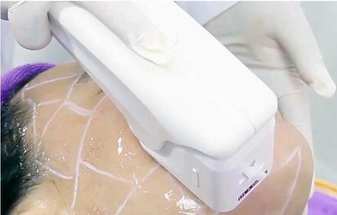 macchine di bellezza di 300W Hifu cartucce di 16mm - di 1.5mm con 15,4» touch screen di colore