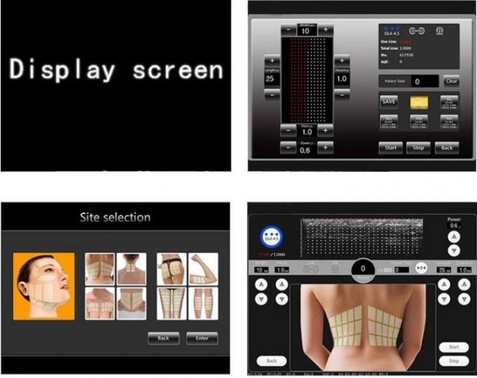 Macchina 44×30×38 cm di bellezza di Hifu dell'anti grinza 2D con il certificato di FDA
