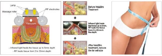 vuoto rf di cavitazione 40K che dimagrisce macchina V9 Velashape con la certificazione del CE