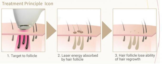 Raffreddamento TECNICO attivo di IPL della macchina permanente del laser con le barre del laser della Germania