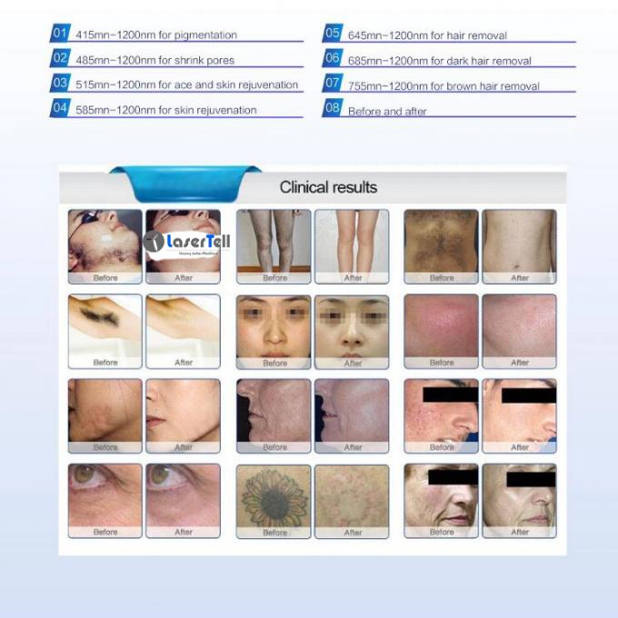 Macchina multifunzionale di bellezza del laser del ND Yag con il sistema operativo intelligente